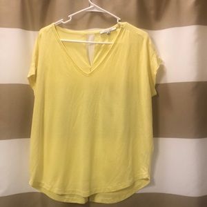 Naked Zebra Yellow Tee